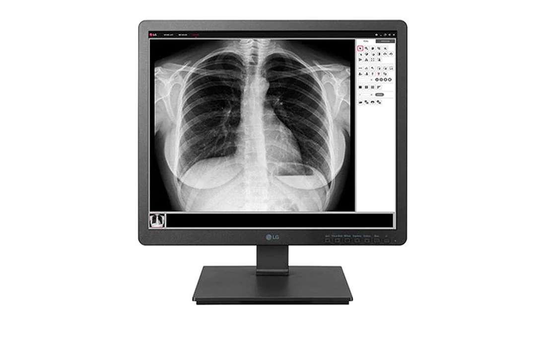 19 (48.26cm) 1.3 MP Clinical Review Monitor 1280 x 1024